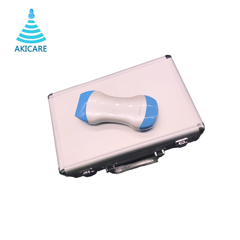 Wireless Ultrasound Three-in-one wireless ultrasound Akicare