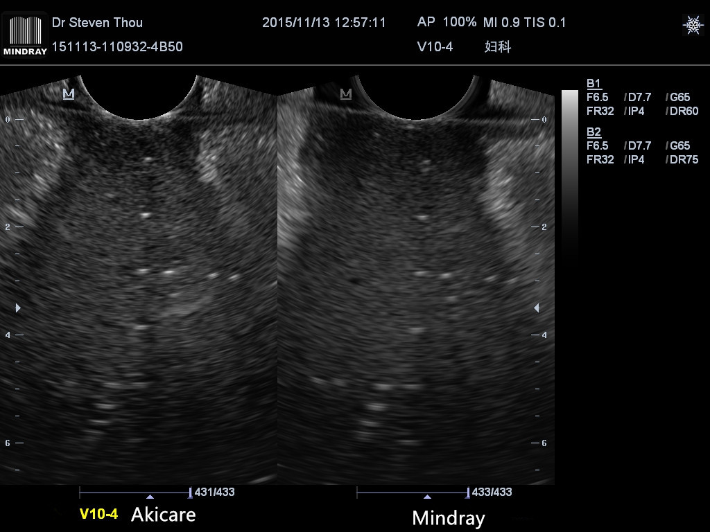 Ultrasound Probes V10-4 Akicare